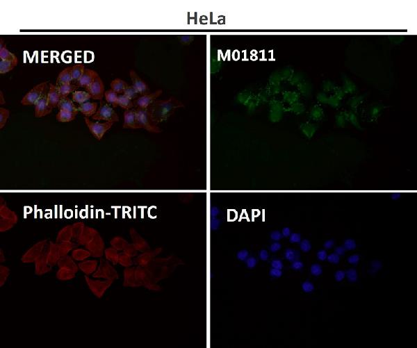 1 - Anti-Lysozyme LYZ Rabbit Monoclonal Antibody ABO13924