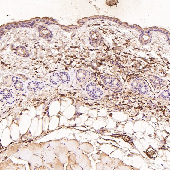 2 - Anti-Lysozyme LYZ Rabbit Monoclonal Antibody ABO13924