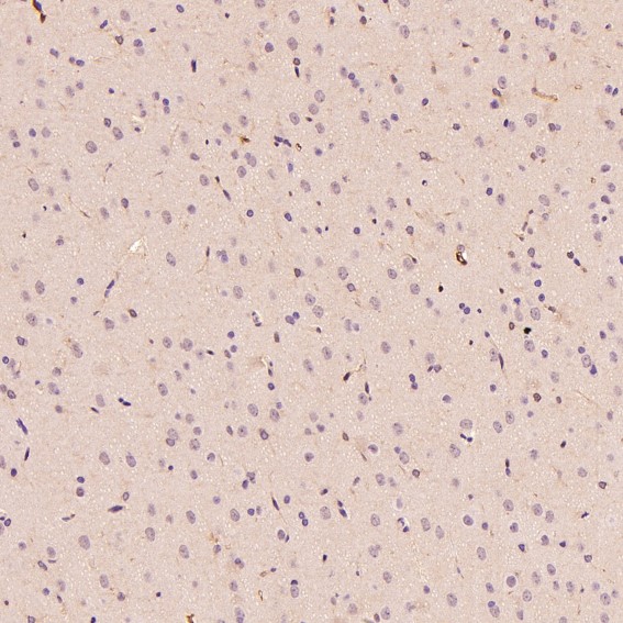 2 - Anti-Lysozyme LYZ Rabbit Monoclonal Antibody ABO13924