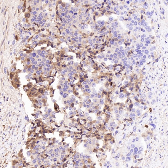 2 - Anti-Lysozyme LYZ Rabbit Monoclonal Antibody ABO13924