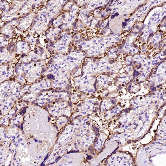 2 - Anti-Lysozyme LYZ Rabbit Monoclonal Antibody ABO13924