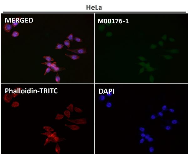 1 - Anti-p38 MAPK MAPK14 Rabbit Monoclonal Antibody ABO13925