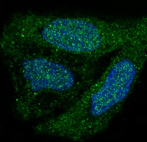 3 - Anti-p38 MAPK MAPK14 Rabbit Monoclonal Antibody ABO13925