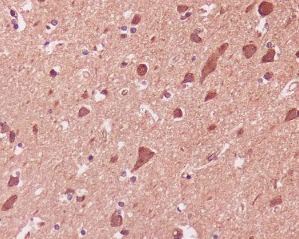 2 - Anti-p38 MAPK MAPK14 Rabbit Monoclonal Antibody ABO13925