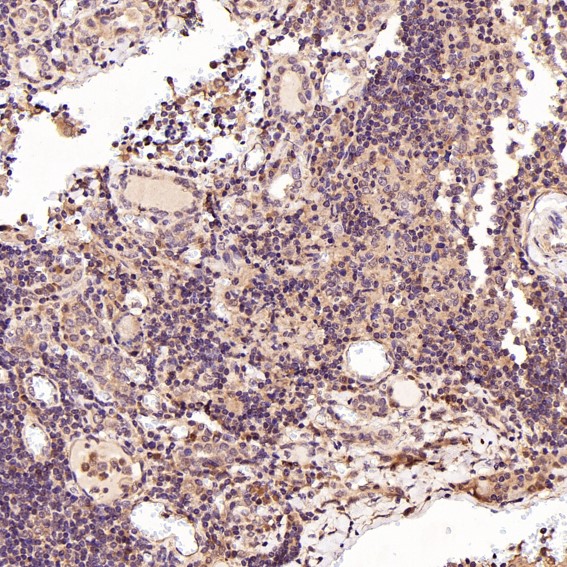 2 - Anti-p38 MAPK MAPK14 Rabbit Monoclonal Antibody ABO13925