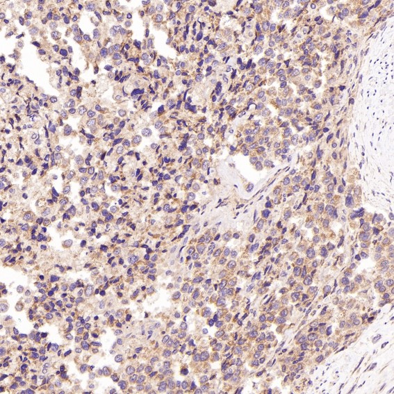 2 - Anti-p38 MAPK MAPK14 Rabbit Monoclonal Antibody ABO13925