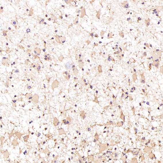2 - Anti-p38 MAPK MAPK14 Rabbit Monoclonal Antibody ABO13925