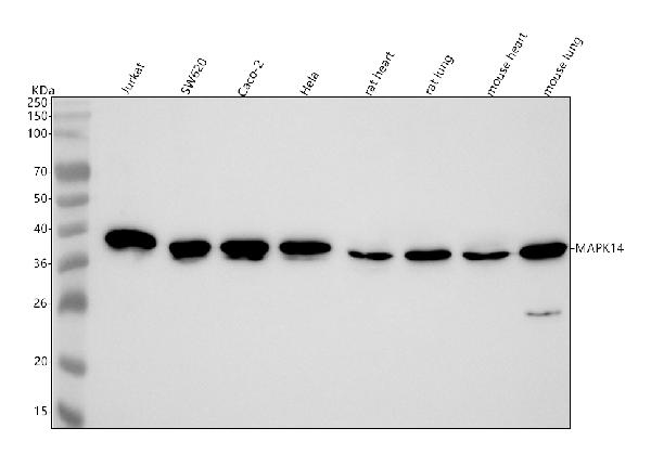 1 - Anti-p38 MAPK MAPK14 Rabbit Monoclonal Antibody ABO13925