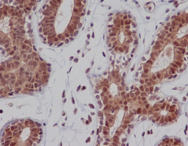 2 - Anti-DNA-PKcs PRKDC Rabbit Monoclonal Antibody ABO13926