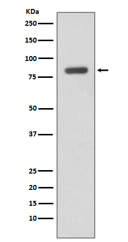 1 - Anti-IKK beta IKBKB Rabbit Monoclonal Antibody ABO13927