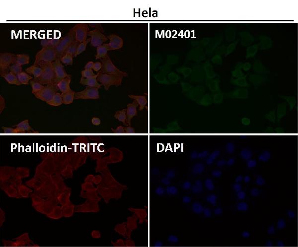 1 - Anti-Ferritin FTH1 Rabbit Monoclonal Antibody ABO13928