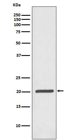 1 - Anti-Ferritin FTH1 Rabbit Monoclonal Antibody ABO13928