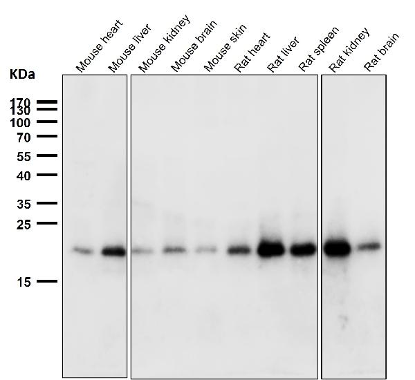 1 - Anti-Ferritin FTH1 Rabbit Monoclonal Antibody ABO13928