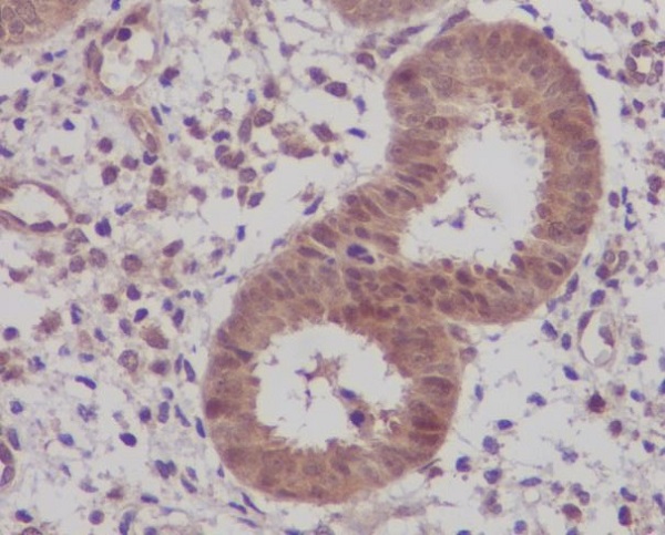 2 - Anti-IKB beta Rabbit Monoclonal Antibody ABO13929