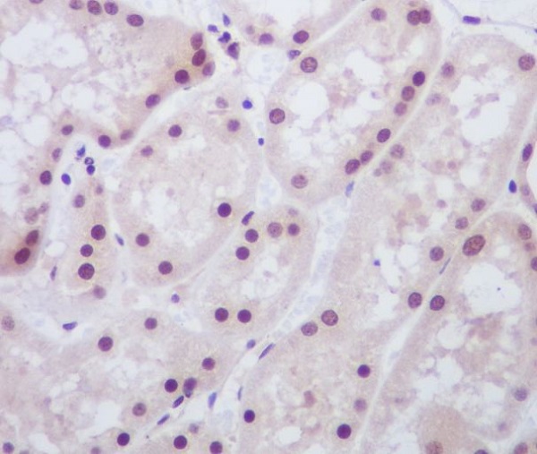 2 - Anti-MAD2L1BP/Mad2L1 Binding Protein Rabbit Monoclonal Antibody ABO13930