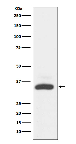 1 - Anti-MAD2L1BP/Mad2L1 Binding Protein Rabbit Monoclonal Antibody ABO13930