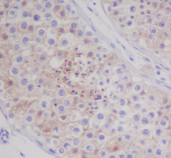 2 - Anti-MAP1LC3A/Lc3A Rabbit Monoclonal Antibody ABO13931