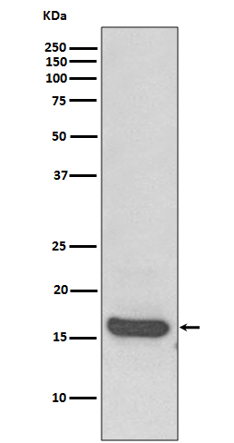 1 - Anti-MAP1LC3A/Lc3A Rabbit Monoclonal Antibody ABO13931