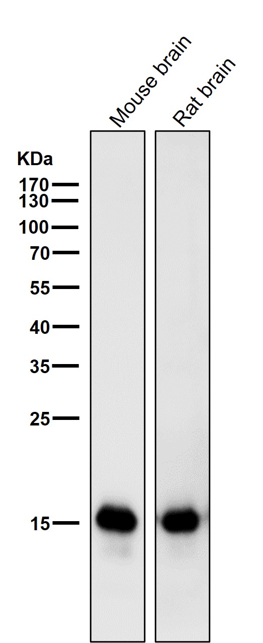 1 - Anti-MAP1LC3A/Lc3A Rabbit Monoclonal Antibody ABO13931