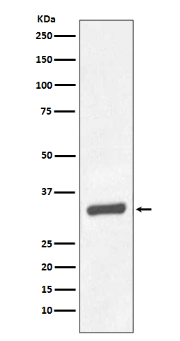 1 - Anti-PSA/KLK3 Rabbit Monoclonal Antibody ABO13932