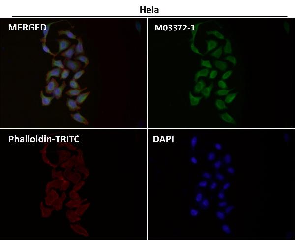 1 - Anti-Calnexin CANX Rabbit Monoclonal Antibody ABO13934