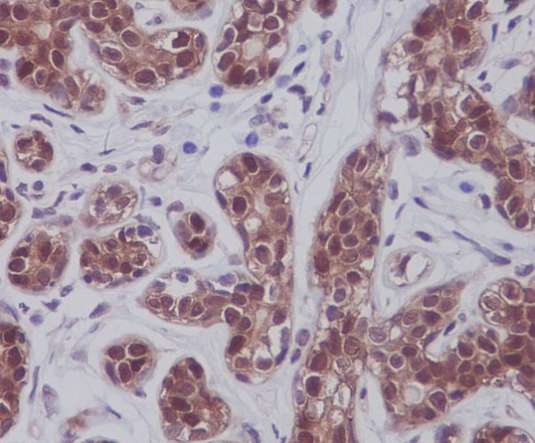 2 - Anti-STAT5A/B Rabbit Monoclonal Antibody ABO13935