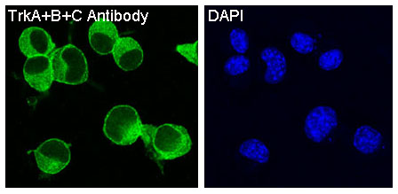 3 - Anti-TrkA+B+C NTRK1 Rabbit Monoclonal Antibody ABO13936