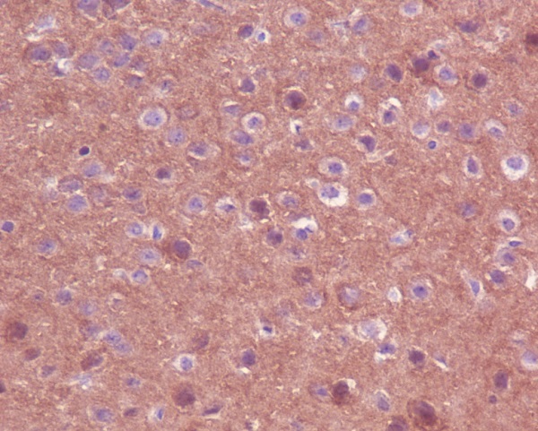 2 - Anti-TrkA+B+C NTRK1 Rabbit Monoclonal Antibody ABO13936