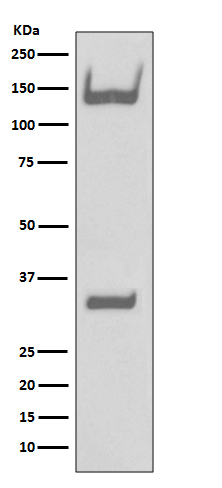 1 - Anti-TrkA+B+C NTRK1 Rabbit Monoclonal Antibody ABO13936