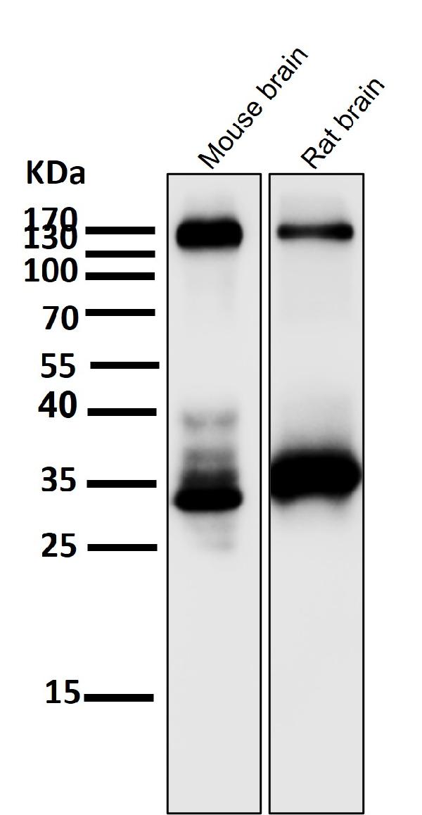 1 - Anti-TrkA+B+C NTRK1 Rabbit Monoclonal Antibody ABO13936