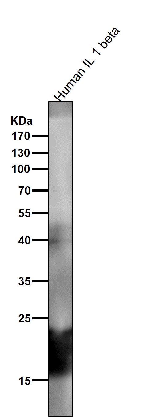 1 - Anti-IL1 beta Rabbit Monoclonal Antibody ABO13938