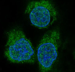 3 - Anti-eIF4EBP1/4Ebp1 Rabbit Monoclonal Antibody ABO13940