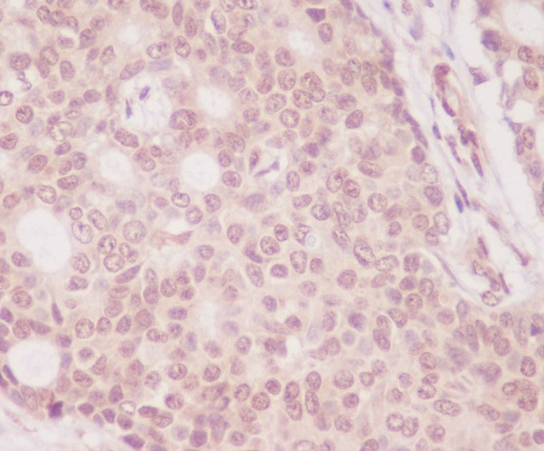 2 - Anti-eIF4EBP1/4Ebp1 Rabbit Monoclonal Antibody ABO13940