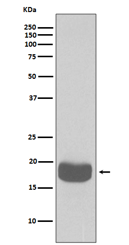 1 - Anti-eIF4EBP1/4Ebp1 Rabbit Monoclonal Antibody ABO13940