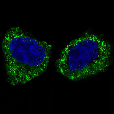 3 - Anti-IKK beta IKBKB Rabbit Monoclonal Antibody ABO13941