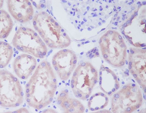 2 - Anti-IKK beta IKBKB Rabbit Monoclonal Antibody ABO13941