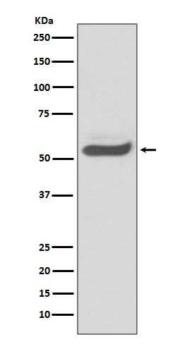 1 - Anti-SERPINA1/Alpha 1 Antitrypsin Rabbit Monoclonal Antibody ABO13943