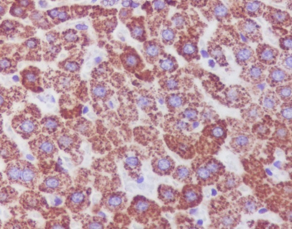 2 - Anti-Catalase Rabbit Monoclonal Antibody ABO13944