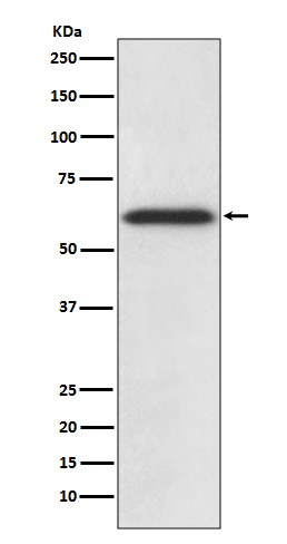 1 - Anti-Catalase Rabbit Monoclonal Antibody ABO13944