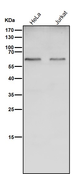 1 - Anti-Catalase Rabbit Monoclonal Antibody ABO13944
