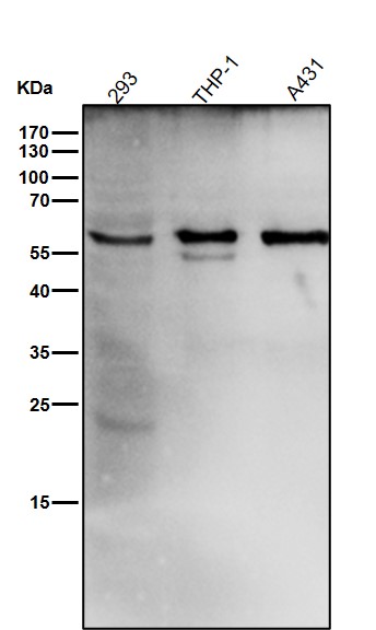 1 - Anti-Catalase Rabbit Monoclonal Antibody ABO13944