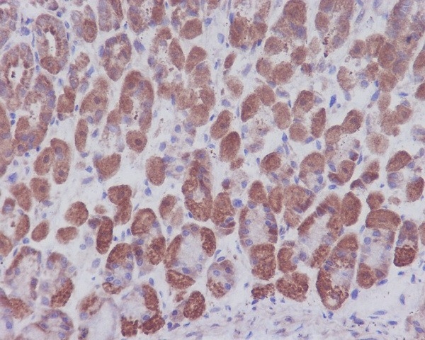 2 - Anti-IKB alpha NFKBIA Rabbit Monoclonal Antibody ABO13949