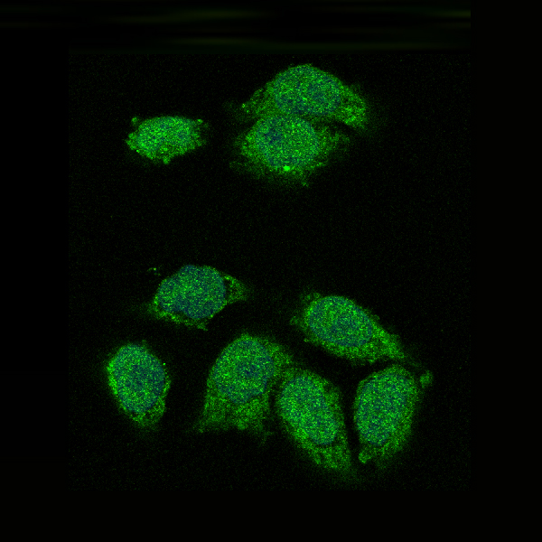 3 - Anti-IKB alpha NFKBIA Rabbit Monoclonal Antibody ABO13949