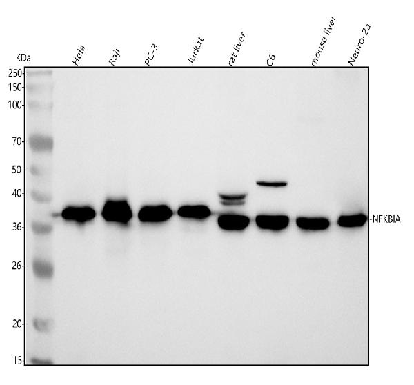 1 - Anti-IKB alpha NFKBIA Rabbit Monoclonal Antibody ABO13949
