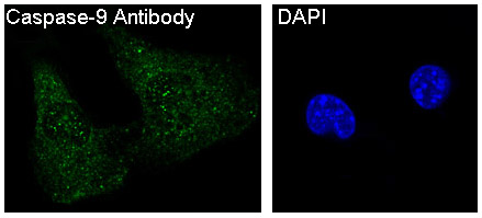 3 - Anti-Caspase-9 CASP9 Rabbit Monoclonal Antibody ABO13951