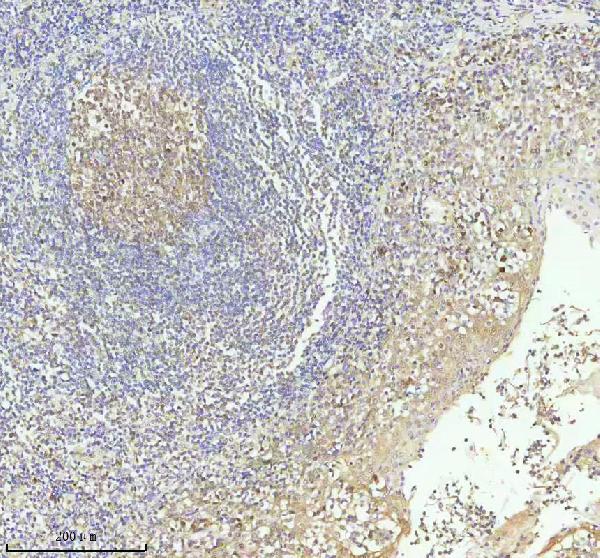 2 - Anti-Caspase-3 CASP3 Rabbit Monoclonal Antibody ABO13952