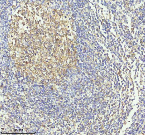 2 - Anti-Caspase-3 CASP3 Rabbit Monoclonal Antibody ABO13952
