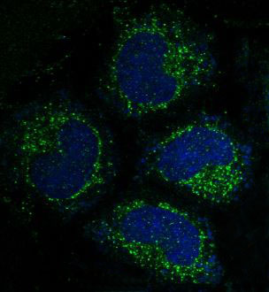 3 - Anti-Caspase-3 CASP3 Rabbit Monoclonal Antibody ABO13952