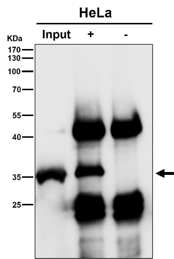 1 - Anti-Caspase-3 CASP3 Rabbit Monoclonal Antibody ABO13952