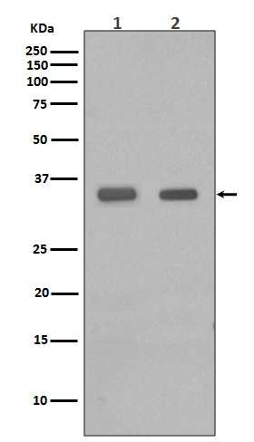 1 - Anti-CEBP Beta Rabbit Monoclonal Antibody ABO13953